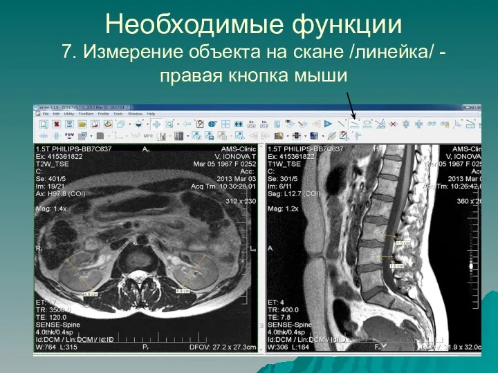 Необходимые функции 7. Измерение объекта на скане /линейка/ - правая кнопка мыши