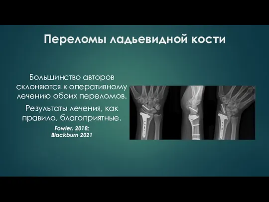 Переломы ладьевидной кости Большинство авторов склоняются к оперативному лечению обоих переломов. Результаты