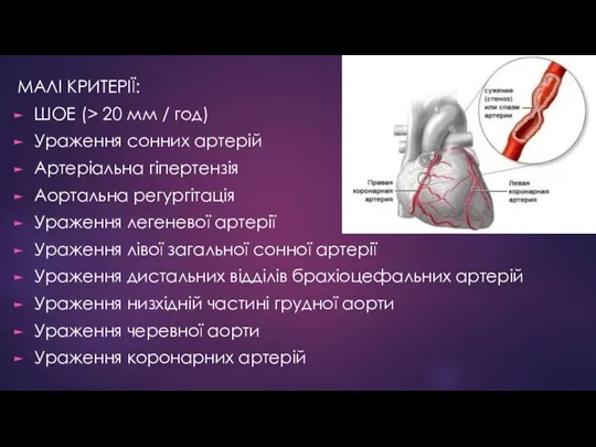 МАЛІ КРИТЕРІЇ: ШОЕ (> 20 мм / год) Ураження сонних артерій Артеріальна