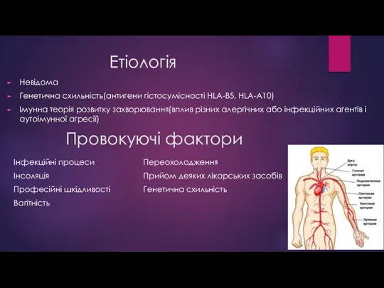 Етіологія Невідома Генетична схильність(антигени гістосумісності HLA-B5, HLA-A10) Імунна теорія розвитку захворювання(вплив різних