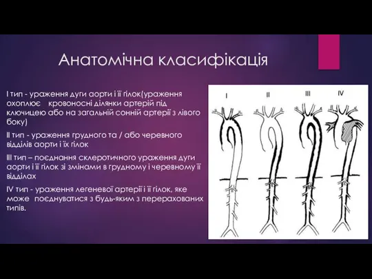 Анатомічна класифікація I тип - ураження дуги аорти і її гілок(ураження охоплює