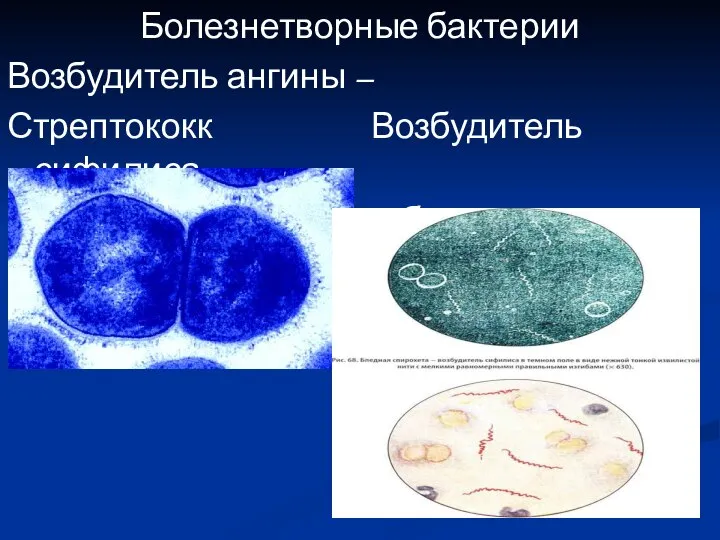 Болезнетворные бактерии Возбудитель ангины – Стрептококк Возбудитель сифилиса – бледная Спирохета