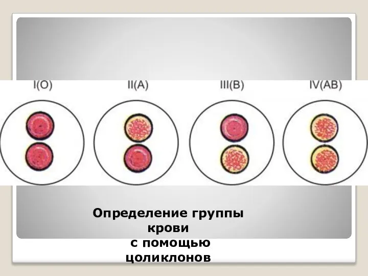 Определение группы крови с помощью цоликлонов
