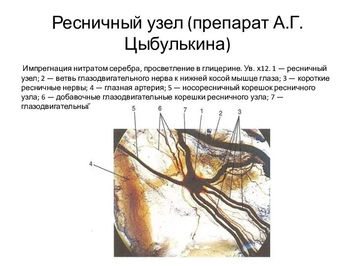 Ресничный узел (препарат А.Г. Цыбулькина) Импрегнация нитратом серебра, просветление в глицерине. Ув.