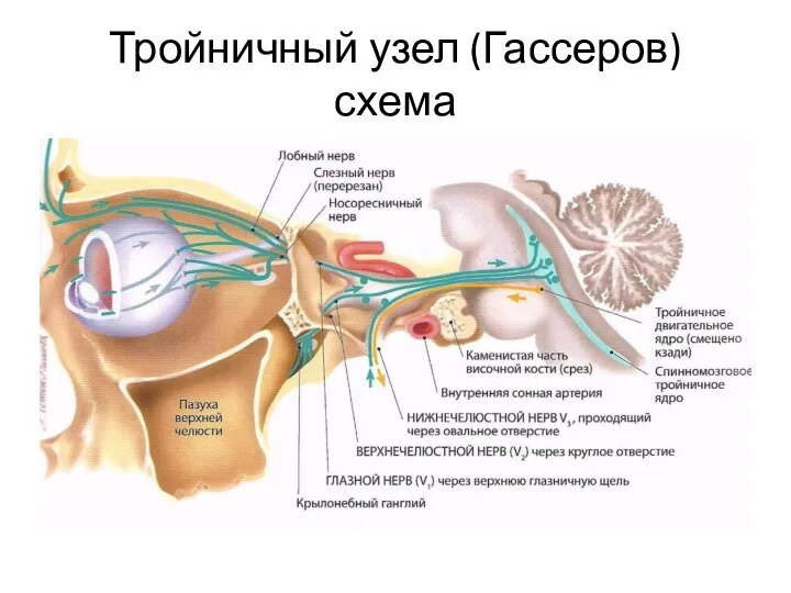 Тройничный узел (Гассеров) схема