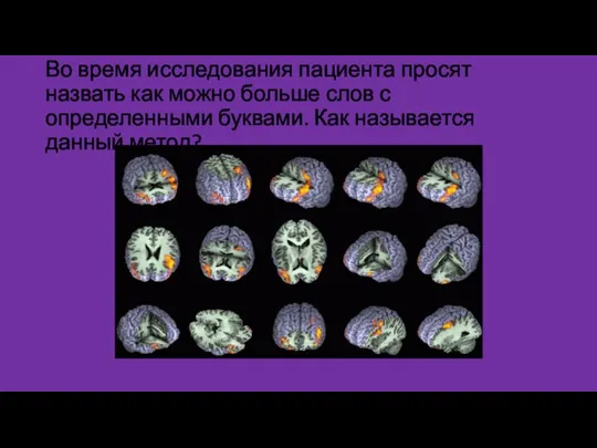 Во время исследования пациента просят назвать как можно больше слов с определенными