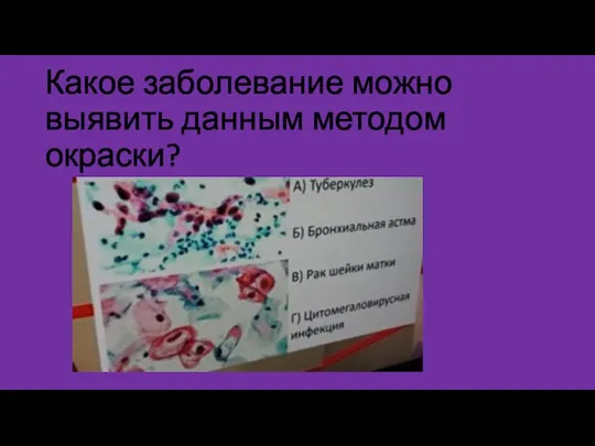 Какое заболевание можно выявить данным методом окраски?