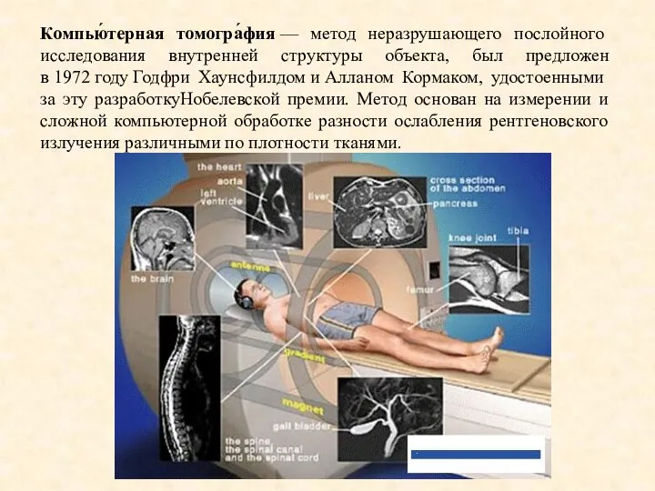 Компью́терная томогра́фия — метод неразрушающего послойного исследования внутренней структуры объекта, был предложен