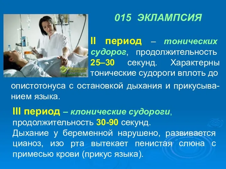 015 ЭКЛАМПСИЯ II период – тонических судорог, продолжительность 25–30 секунд. Характерны тонические