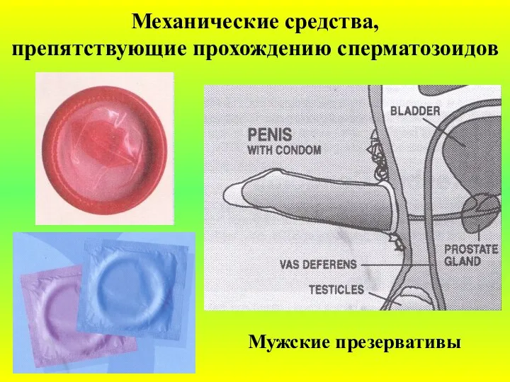 Механические средства, препятствующие прохождению сперматозоидов Мужские презервативы