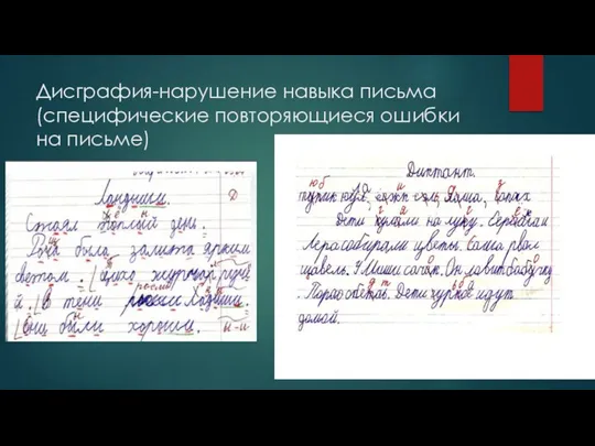 Дисграфия-нарушение навыка письма (специфические повторяющиеся ошибки на письме)