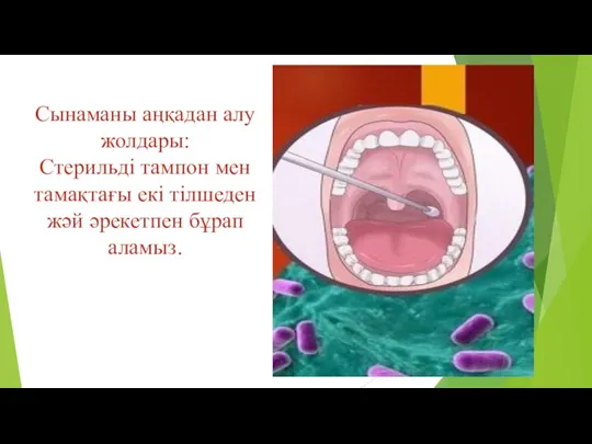 Сынаманы аңқадан алу жолдары: Стерильді тампон мен тамақтағы екі тілшеден жәй әрекетпен бұрап аламыз.