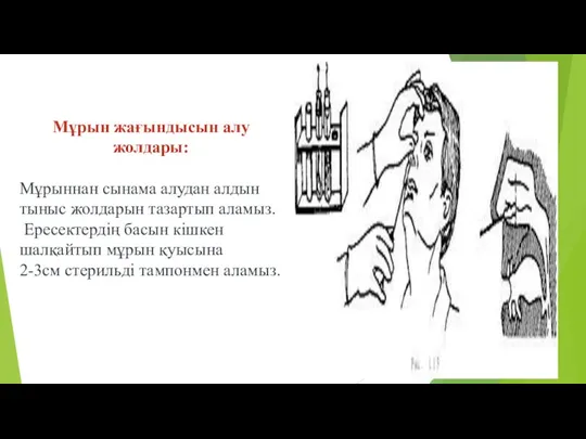 Мұрын жағындысын алу жолдары: Мұрыннан сынама алудан алдын тыныс жолдарын тазартып аламыз.