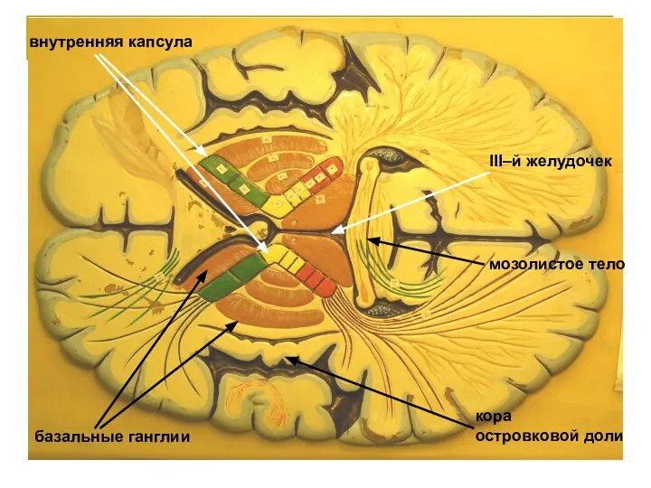 внутренняя капсула базальные ганглии III–й желудочек мозолистое тело кора островковой доли