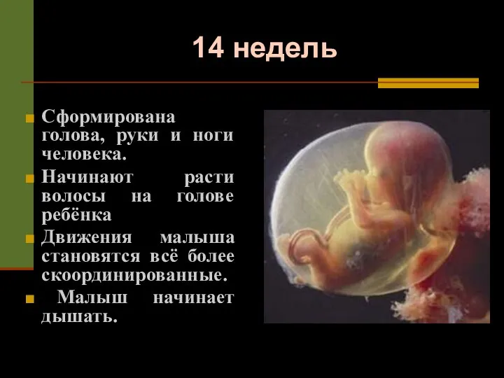 14 недель Сформирована голова, руки и ноги человека. Начинают расти волосы на