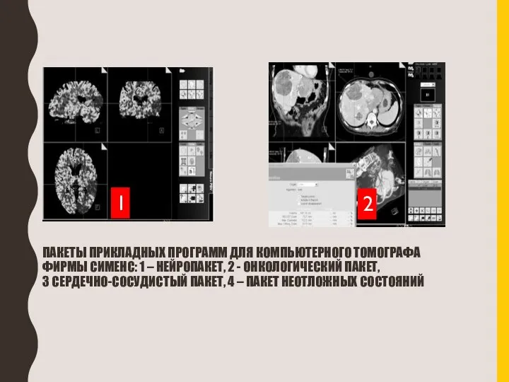 ПАКЕТЫ ПРИКЛАДНЫХ ПРОГРАММ ДЛЯ КОМПЬЮТЕРНОГО ТОМОГРАФА ФИРМЫ СИМЕНС: 1 – НЕЙРОПАКЕТ, 2