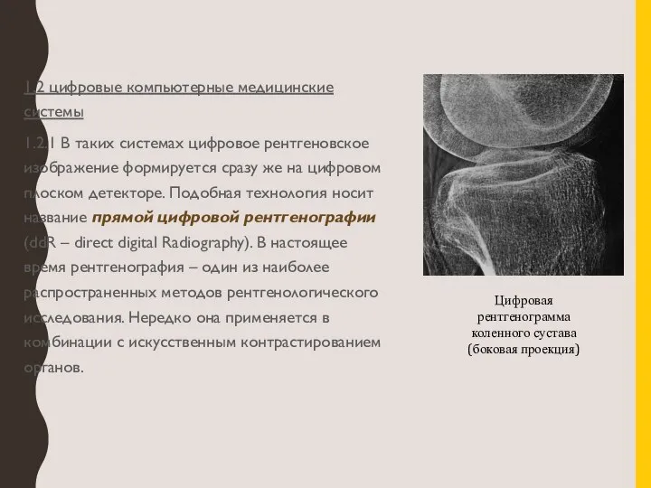 1.2 цифровые компьютерные медицинские системы 1.2.1 В таких системах цифровое рентгеновское изображение