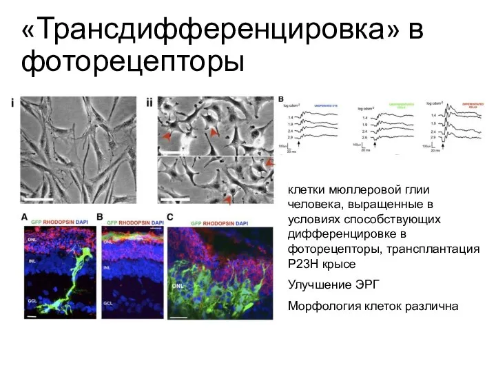 «Трансдифференцировка» в фоторецепторы клетки мюллеровой глии человека, выращенные в условиях способствующих дифференцировке