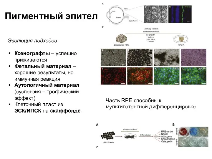 Пигментный эпителий Эволюция подходов Ксенографты – успешно приживаются Фетальный материал –хорошие результаты,