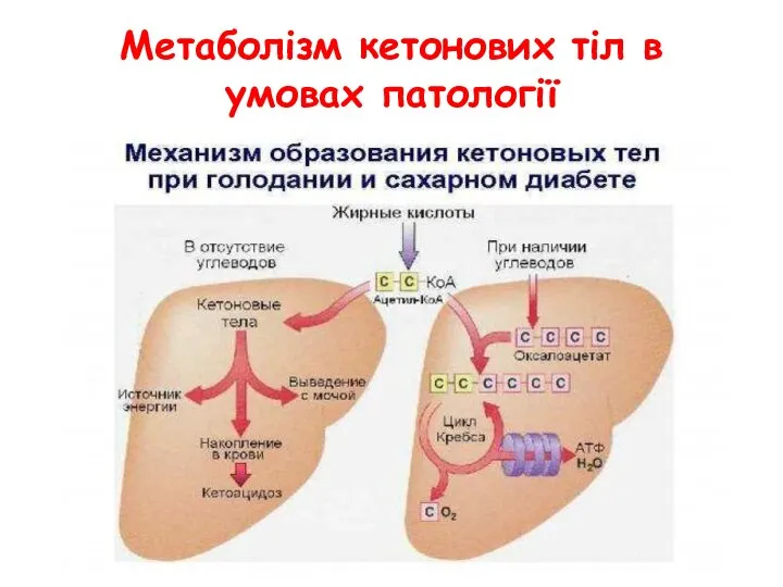 Метаболізм кетонових тіл в умовах патології