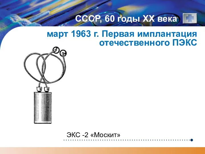 СССР, 60 годы XX века март 1963 г. Первая имплантация отечественного ПЭКС ЭКС -2 «Москит»