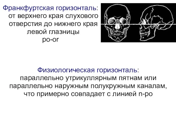 Франкфуртская горизонталь: от верхнего края слухового отверстия до нижнего края левой глазницы