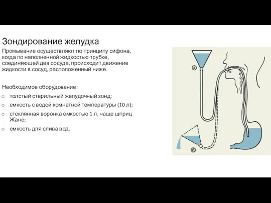 Зондирование желудка Промывание осуществляют по принципу сифона, когда по наполненной жидкостью трубке,