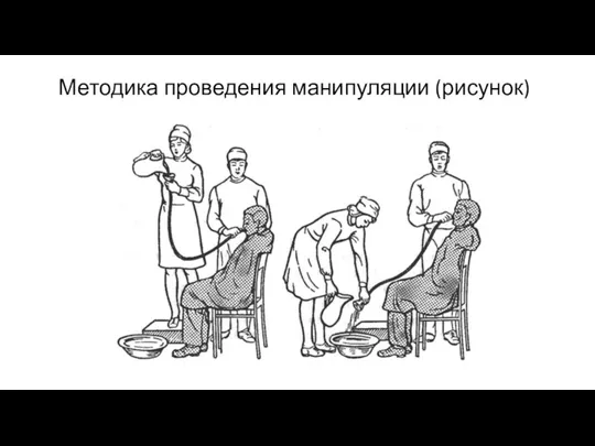 Методика проведения манипуляции (рисунок)