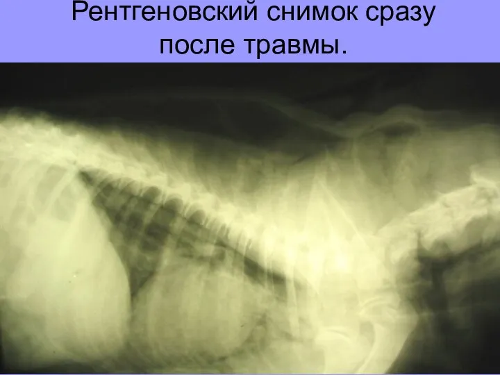 Рентгеновский снимок сразу после травмы.