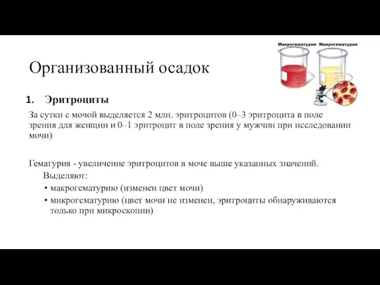 Организованный осадок Эритроциты За сутки с мочой выделяется 2 млн. эритроцитов (0–3