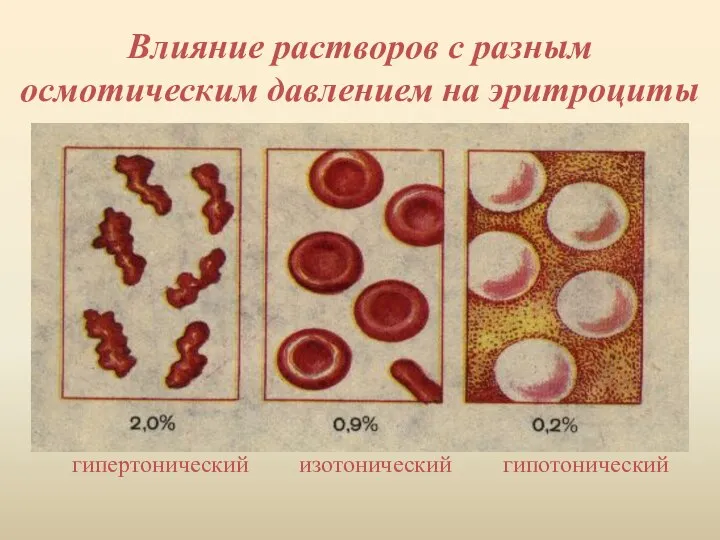 Влияние растворов с разным осмотическим давлением на эритроциты гипотонический изотонический гипертонический