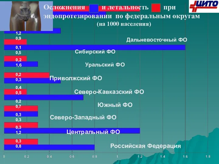 Осложнения и летальность при эндопротезировании по федеральным округам (на 1000 населения) Российская