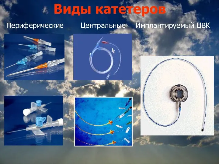 Виды катетеров Периферические Центральные Имплантируемый ЦВК