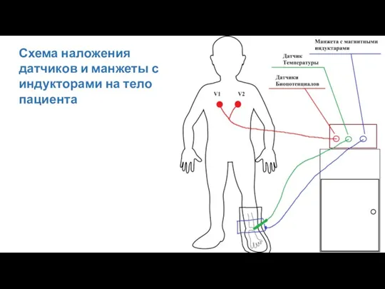 Схема наложения датчиков и манжеты с индукторами на тело пациента