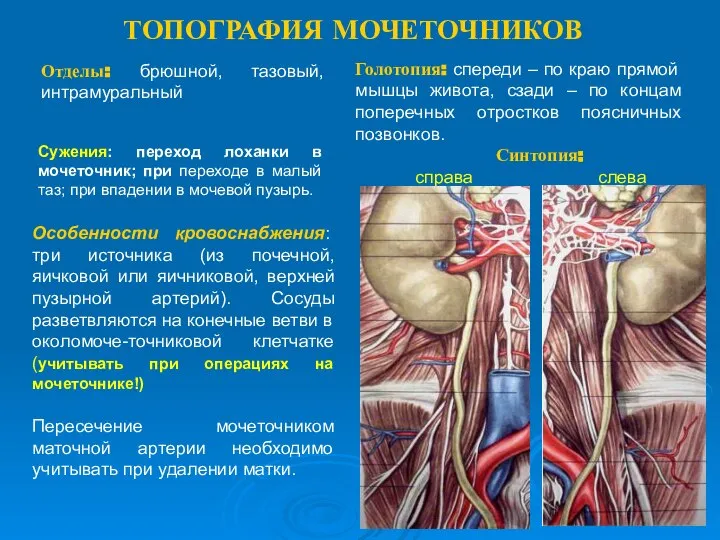 ТОПОГРАФИЯ МОЧЕТОЧНИКОВ Сужения: переход лоханки в мочеточник; при переходе в малый таз;