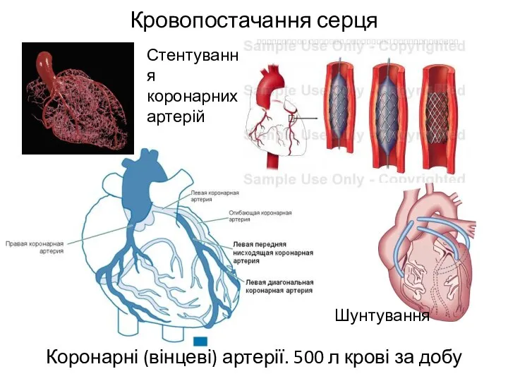 Кровопостачання серця Коронарні (вінцеві) артерії. 500 л крові за добу Стентування коронарних артерій Шунтування