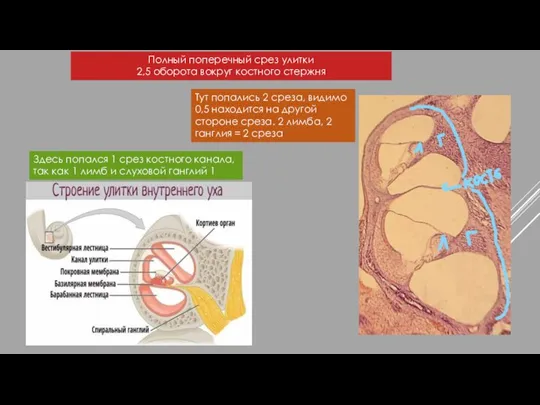 Полный поперечный срез улитки 2,5 оборота вокруг костного стержня Здесь попался 1