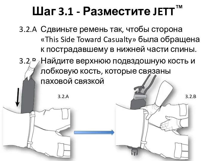 Шаг 3.1 - Разместите JETT™ 3.2.A Сдвиньте ремень так, чтобы сторона «This