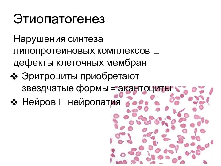 Этиопатогенез Нарушения синтеза липопротеиновых комплексов ? дефекты клеточных мембран Эритроциты приобретают звездчатые