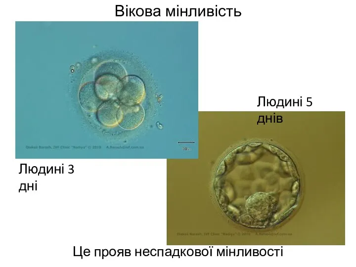 Вікова мінливість Це прояв неспадкової мінливості Людині 3 дні Людині 5 днів