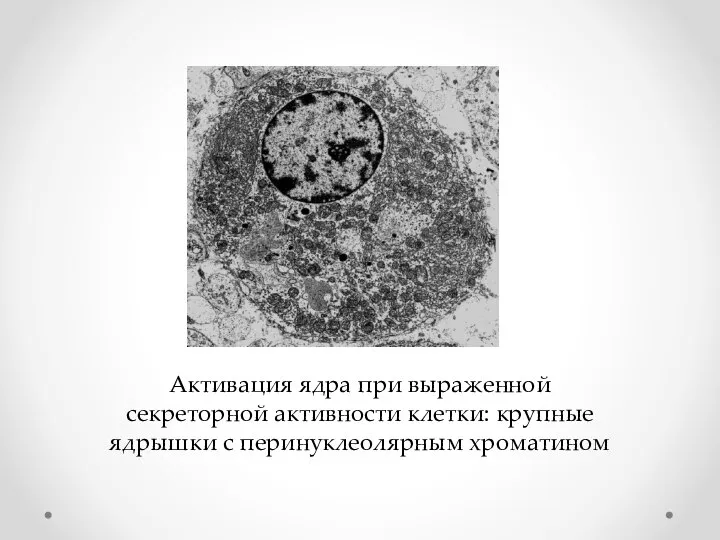 Активация ядра при выраженной секреторной активности клетки: крупные ядрышки с перинуклеолярным хроматином