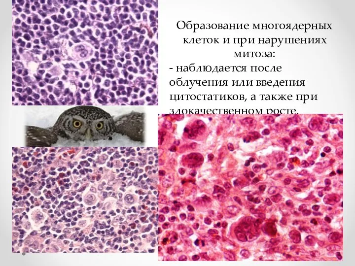 Образование многоядерных клеток и при нарушениях митоза: - наблюдается после облучения или