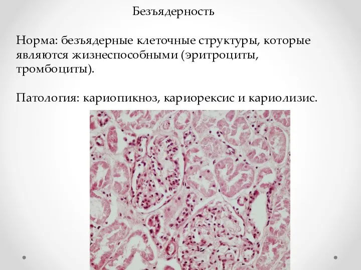 Безъядерность Норма: безъядерные клеточные структуры, которые являются жизнеспособными (эритроциты, тромбоциты). Патология: кариопикноз, кариорексис и кариолизис.