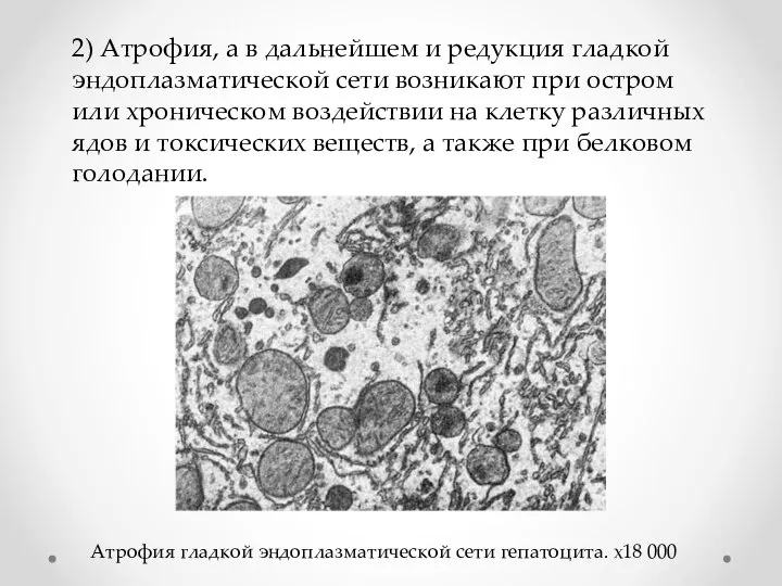 2) Атрофия, а в дальнейшем и редукция гладкой эндоплазматической сети возникают при