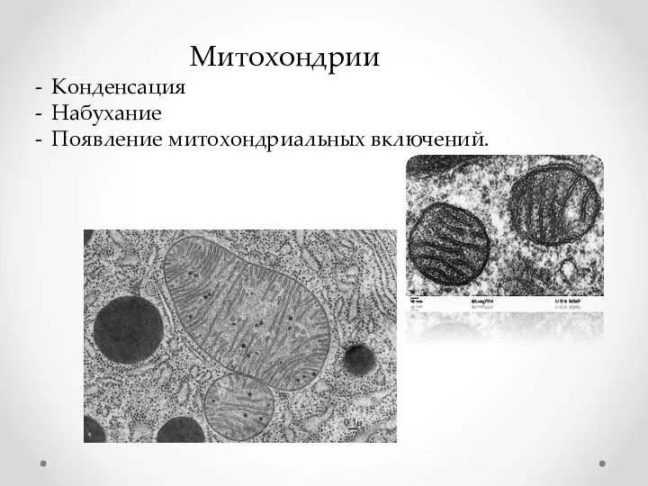 Митохондрии Конденсация Набухание Появление митохондриальных включений.