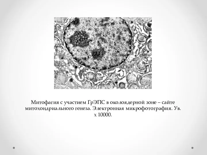 Митофагия с участием ГрЭПС в околоядерной зоне – сайте митохондриального генеза. Электронная микрофотография. Ув. х 10000.