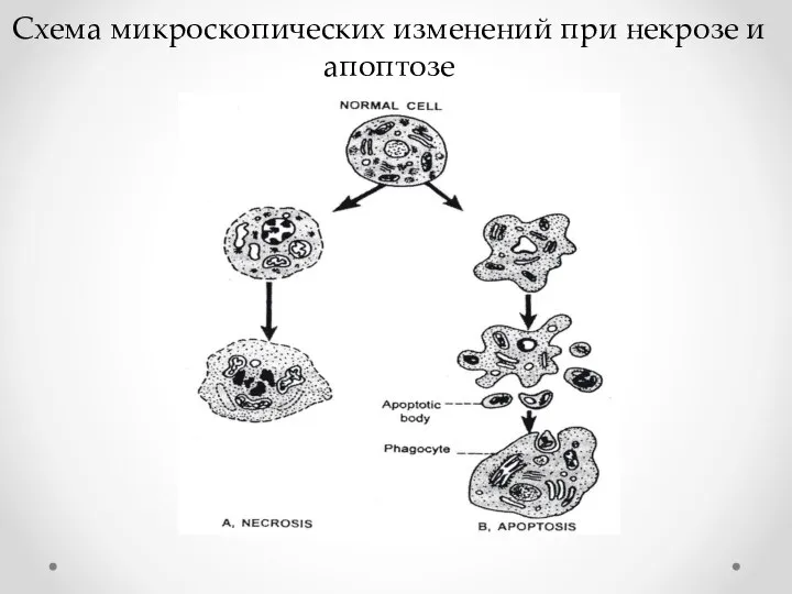 Схема микроскопических изменений при некрозе и апоптозе