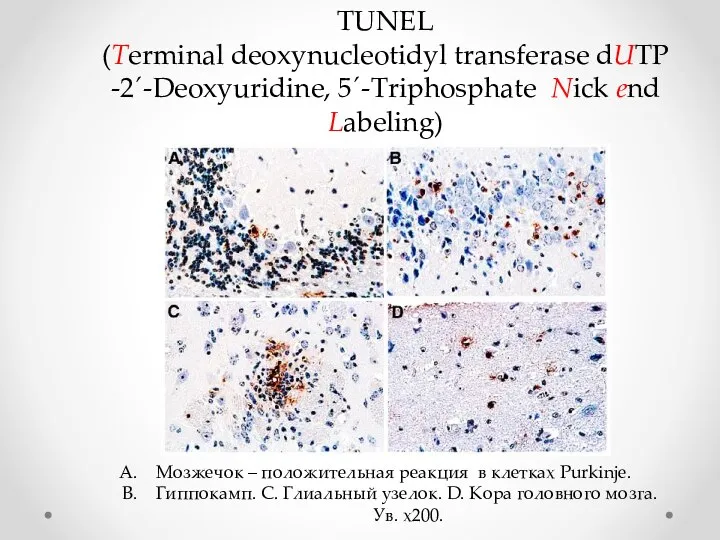 TUNEL (Terminal deoxynucleotidyl transferase dUTP -2´-Deoxyuridine, 5´-Triphosphate Nick end Labeling) Мозжечок –