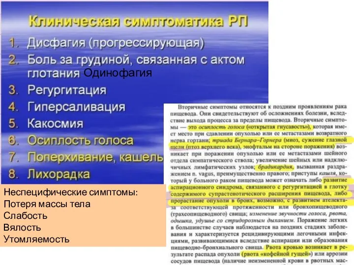 Одинофагия Неспецифические симптомы: Потеря массы тела Слабость Вялость Утомляемость