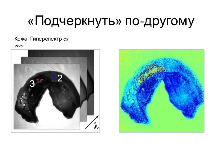 «Подчеркнуть» по-другому Кожа. Гиперспектр ex vivo